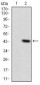 ITGAM Antibody